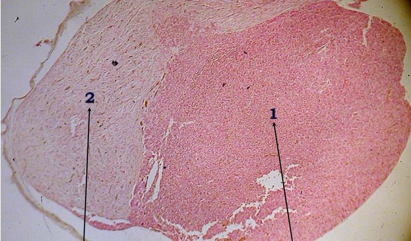<p>2 Name &amp; hormone it secretes</p>