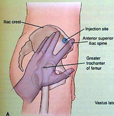 <p>Greater Trochanter/Iliac crest/Iliac spine</p>