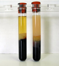 <p>the increased presence of triglycerides in the serum </p><p>causes a milky apperance</p>