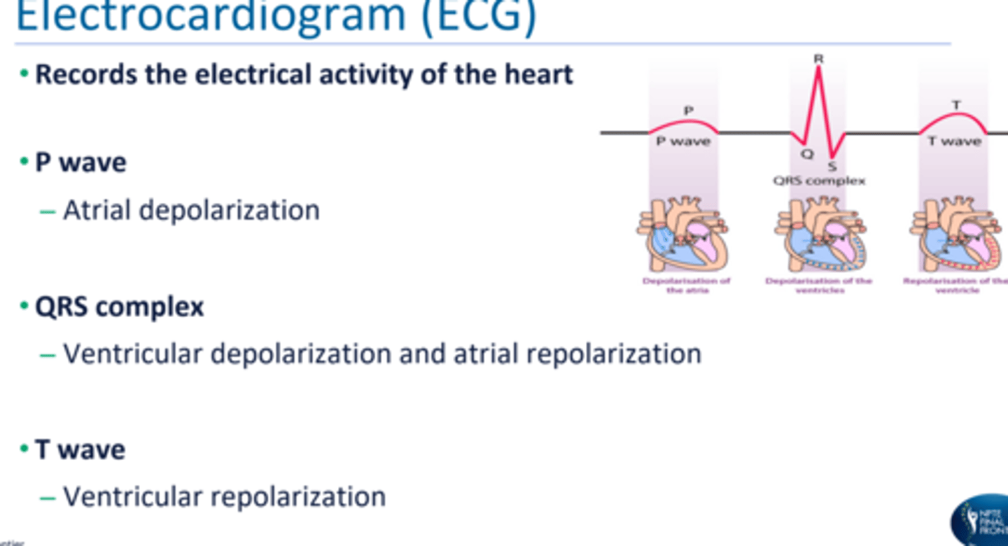 <p>records the electrical activity of the heart</p><p>P wave: atrial depolarization</p><p>QRS complex: ventricular depolarization and atrial repolarization</p><p>T wave: ventricular repolarization </p>