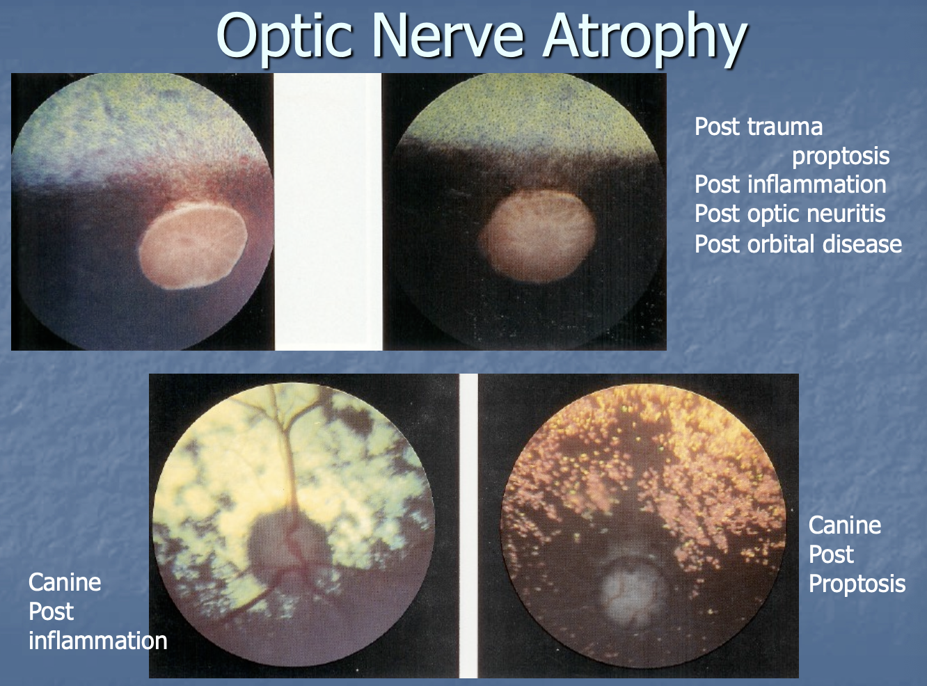 <p>trauma/proptosis.</p><p>inflammation.</p><p>optic neuritis.</p><p>orbital dz.</p>