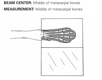 <p>Dorsopalmer view for metacarpus-phalanges</p>