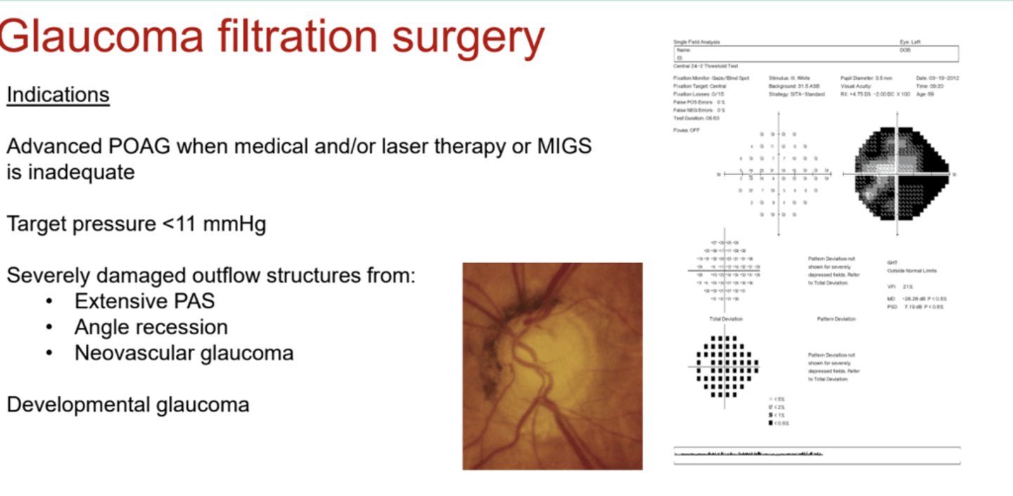 <p>What are the indications for a glaucoma filtration surgery?</p>