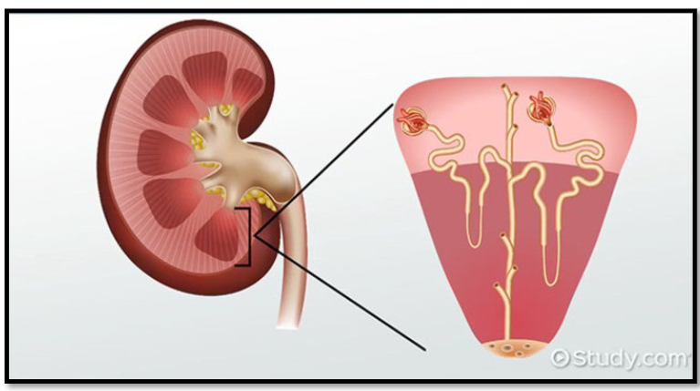 <ul><li><p>salt content</p></li><li><p>Structures present</p></li></ul><p></p>