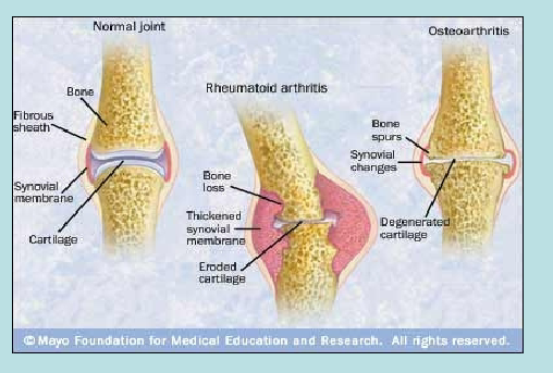 <p>Synovial Joints  </p>