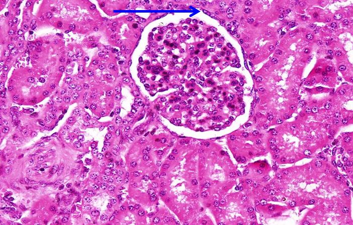 <p>Biểu mô gì ?</p>