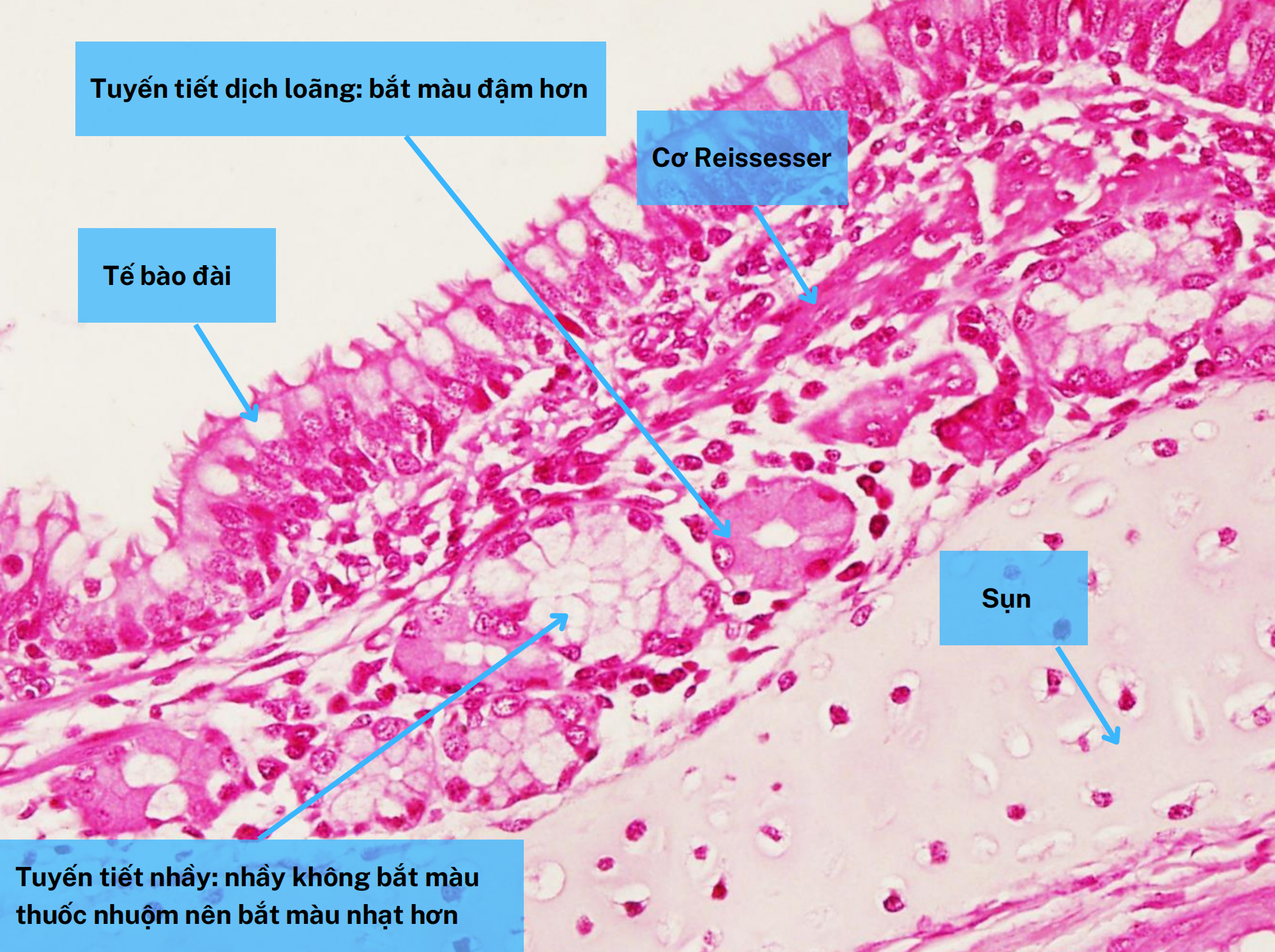 <ol><li><p>Tuyến tiết dịch loãng</p></li><li><p>Lớp cơ Reissessen</p></li><li><p>Tế bào đài</p></li><li><p>Tuyến tiết dịch nhầy </p></li></ol><p></p>