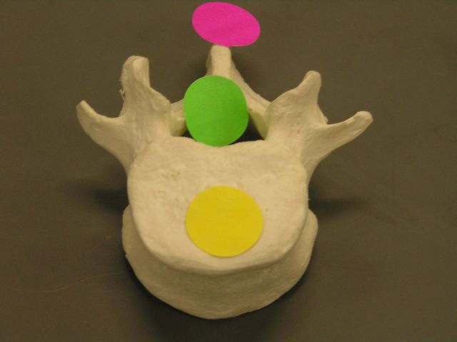 <p><span>Identify the structure indicated by the pink dot.</span></p>