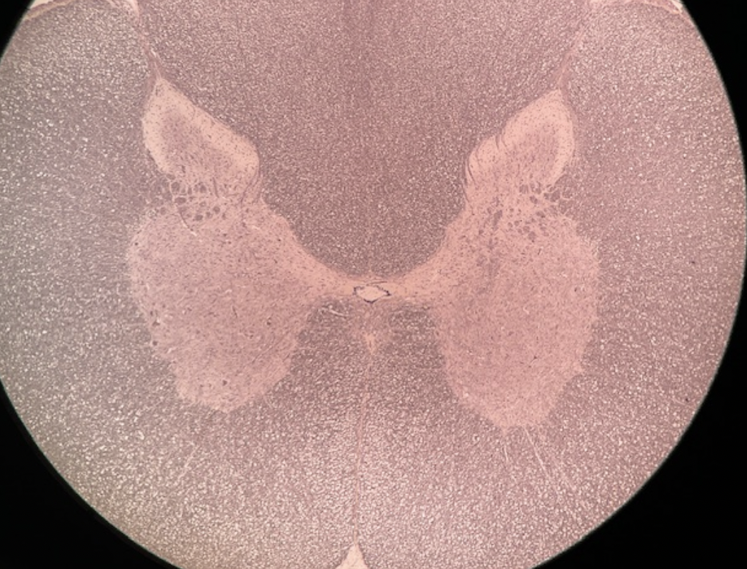 <p><strong>CNS</strong></p><p>Identify the region of the spinal cord this cross section is from.</p>