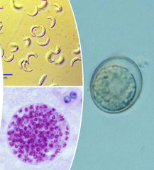 <p>These are 3 forms for what protozoal disease in cats?</p>