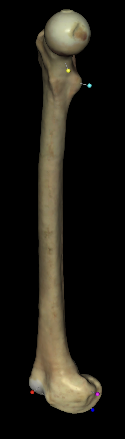 <p>what is the baby blue tag on the right femurs?</p>