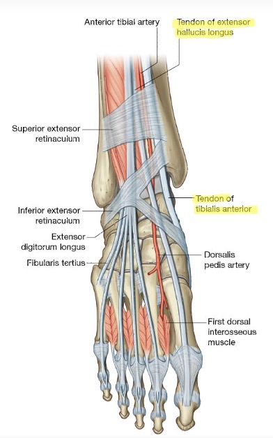 <p><span><span>A. Tibalis anterior loopt tussen pees m. Tibialis anterior en pees van m. Extensor hallucis longus.</span></span></p>
