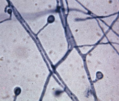<p>Mold Phase. Single conidia on short conidiophore "lollipop". Causes Blastomycosis</p>