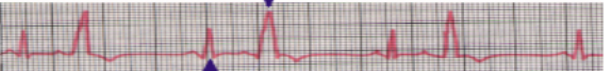 <p>what waveform is this</p>