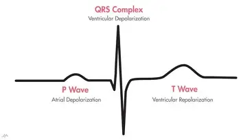 <p>T-Wave</p>