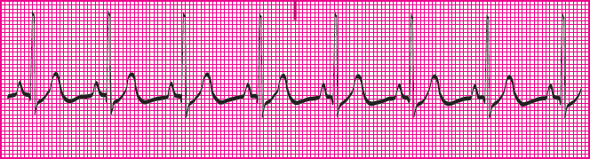 <p>Which rhythm is this?</p>
