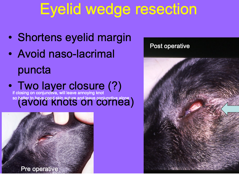 <p>shortens eyelid margin.</p>