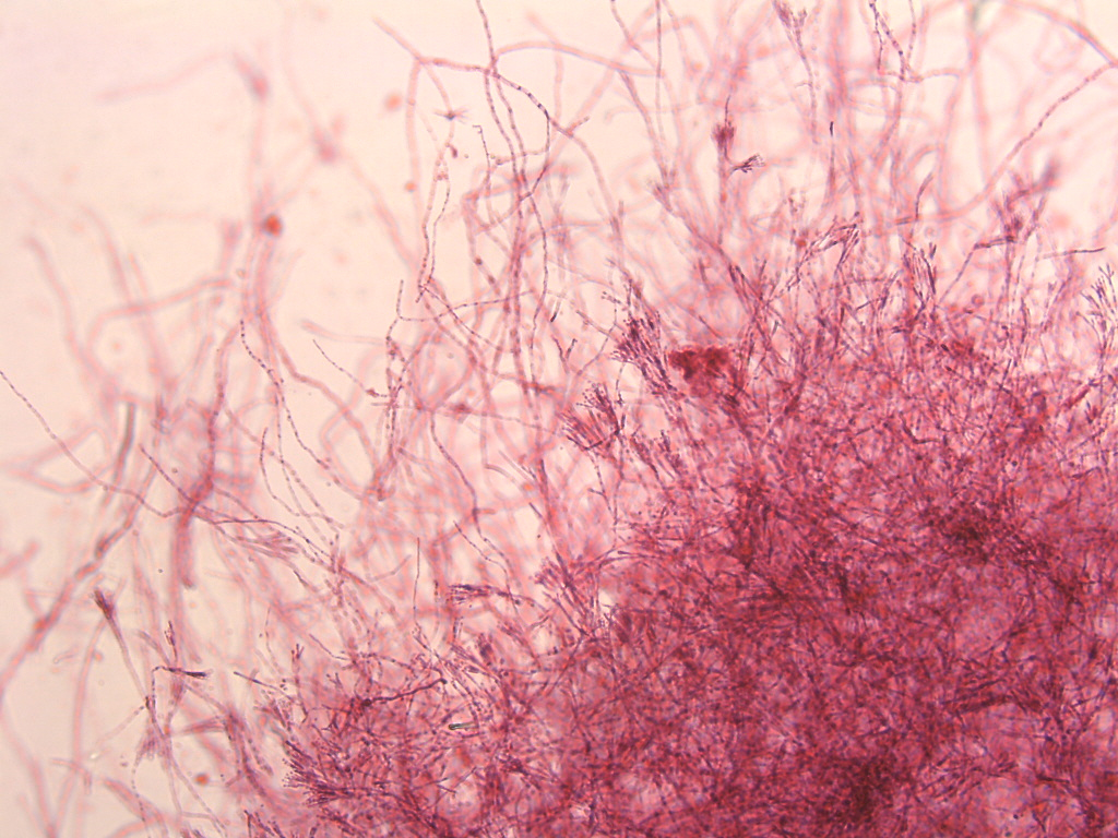 <p><span style="background-color: transparent;">Penicillium</span></p>