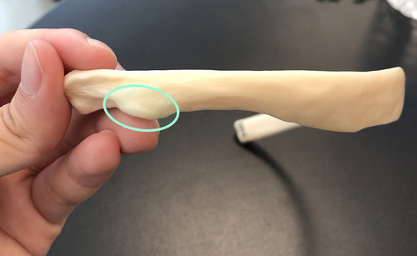 <p>Articulates with transverse process</p>