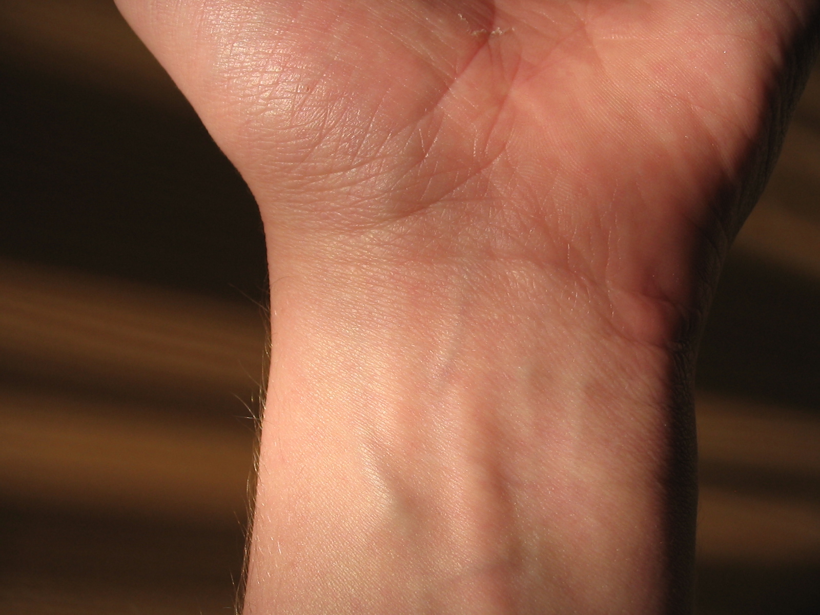 <p>carpal</p>