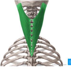 <p>Splenius capitis</p>