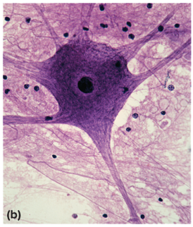 <p>structural classification of neurons</p>