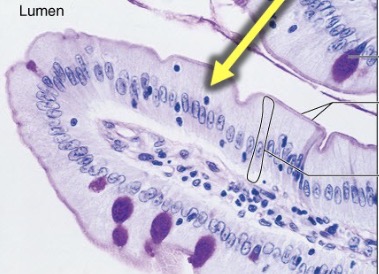 <p>What is the type tissue in this image?</p>