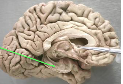 <p>What is the green arrow pointing to?</p>