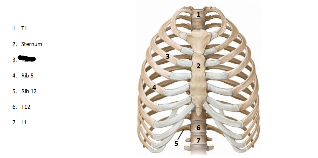<p>What structure is this within the <strong>Spine? (ANTERIOR OF AXIAL)</strong></p>