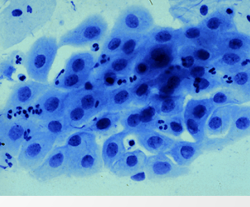 <p>Parabasal (epithelial) </p>
