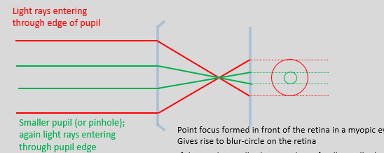 <p>blur circle and their dependence on pupil size </p>
