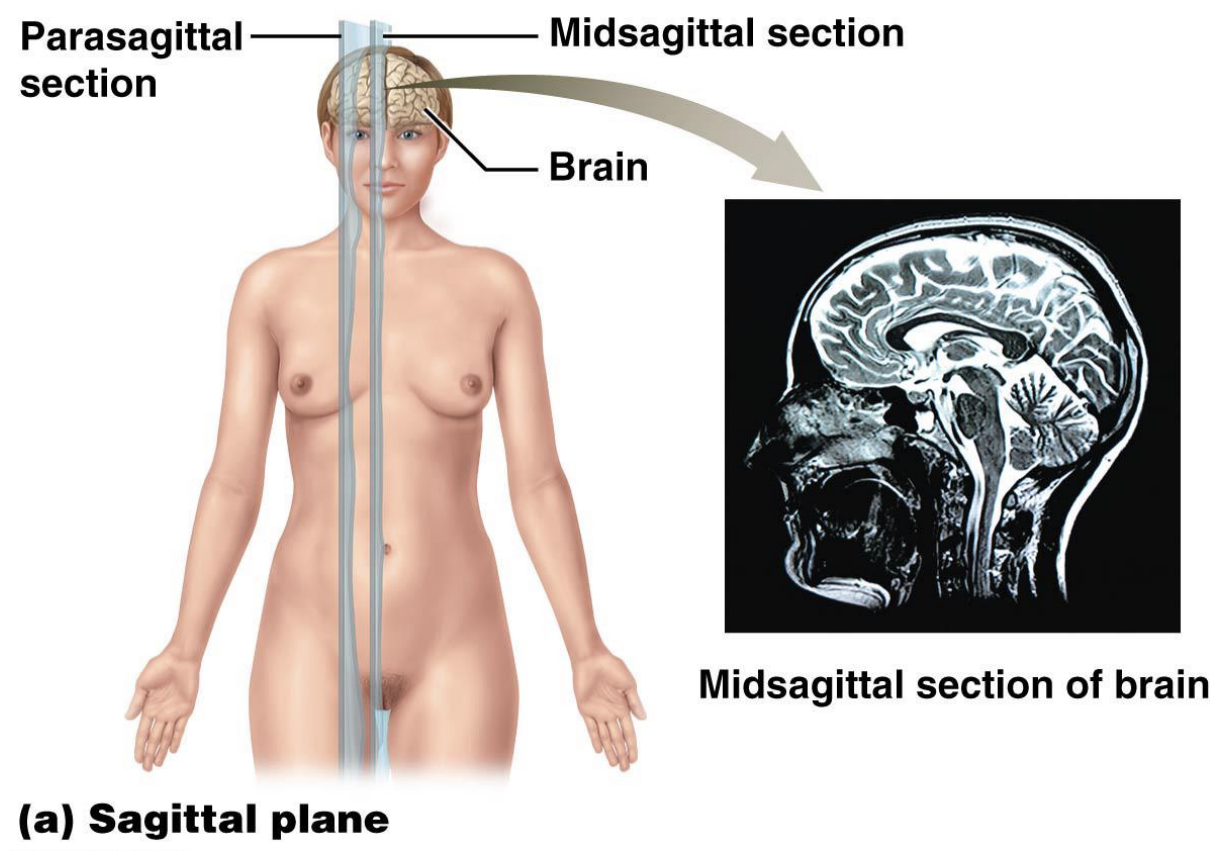 <p>Sagittal plane divides body or body part into right and left sections: </p><ul><li><p>Midsagittal plane (median plane) divides body or body part into equal left and right sections </p></li><li><p>Parasagittal plane divides body or body part into unequal right and left sections</p></li></ul><p></p>
