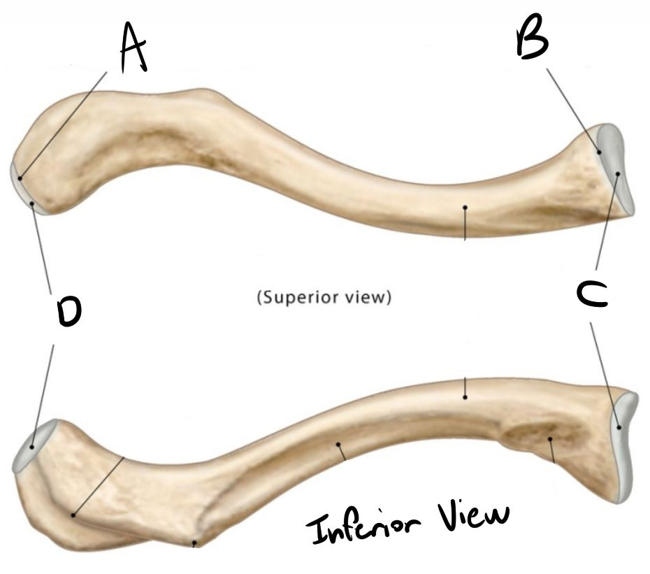 <p>What bone is this?</p>