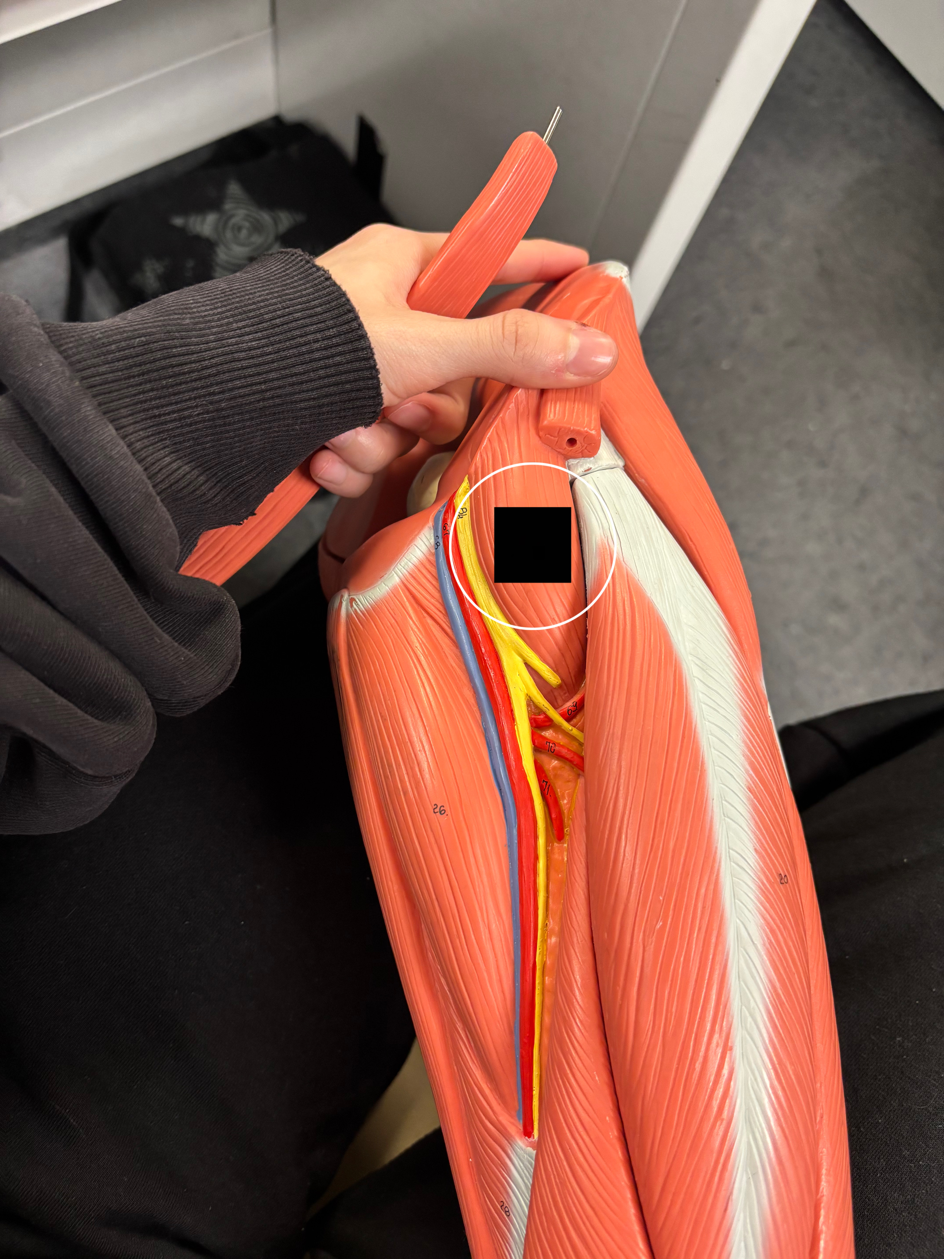 <p>What muscle is this and what is its action?</p>