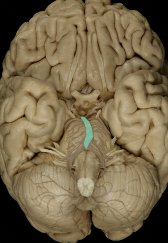 <p>Identify the artery to the brain (circle of willis)</p>