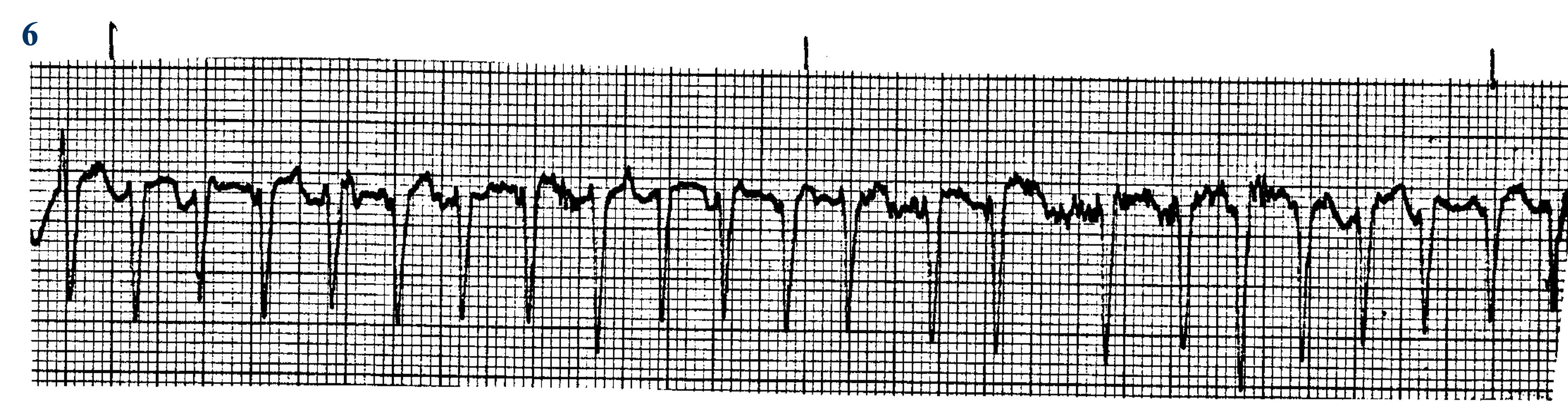 <p>What ECG is this? </p>