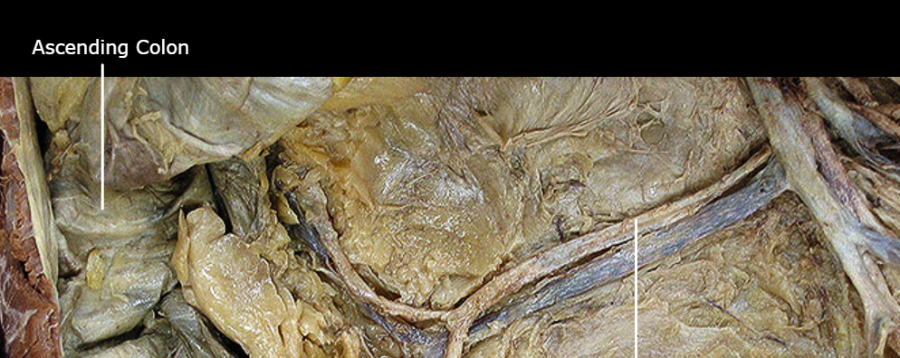 <p>What structure is this?</p>