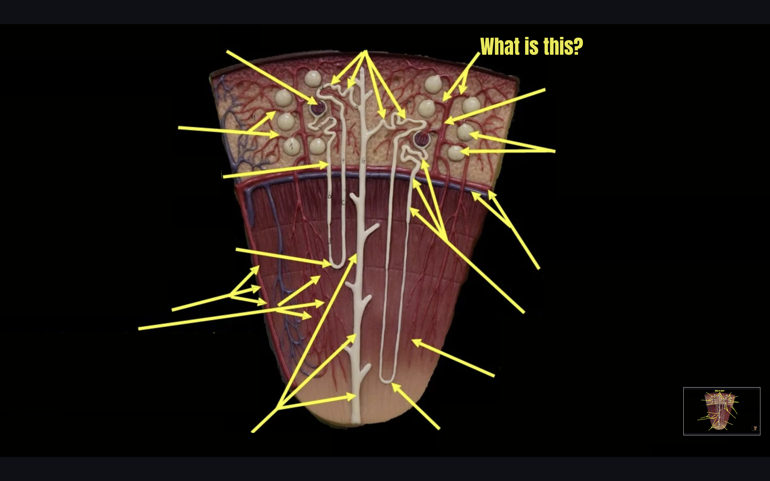 term image