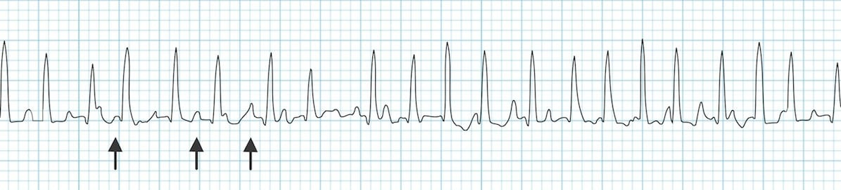 <p>What rhythm is this?</p>