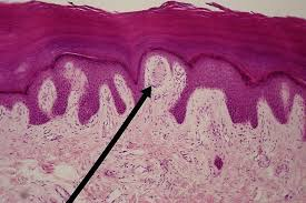 <p><strong>D) Corpúsculo de Meissner</strong></p>