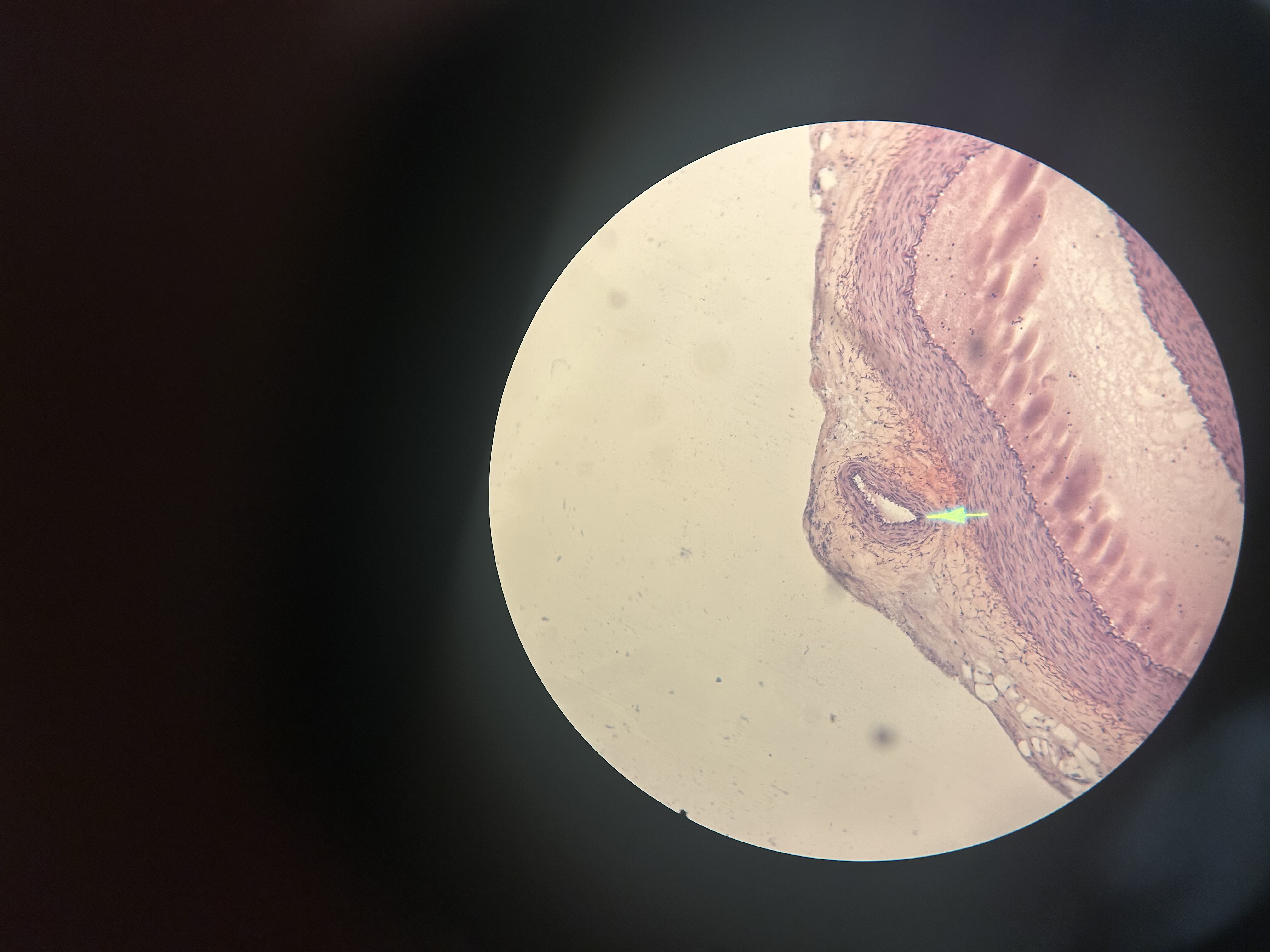 <p>-Artery</p><p>-Arrow points to a vein</p>