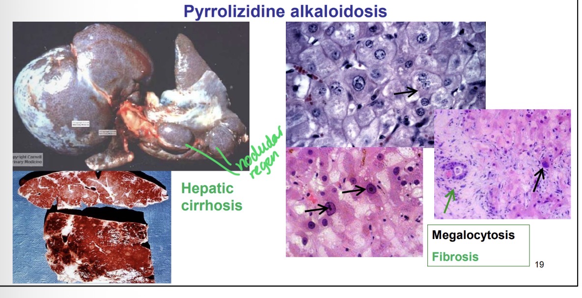 <p>pyrrolizidine alkalosis - gross</p>