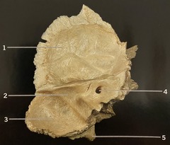 <p>What structure is #4? (Fig. 3.12 Left Temporal Bone, Medial View)</p>