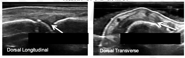 <p>What is the arrow pointing to?</p>