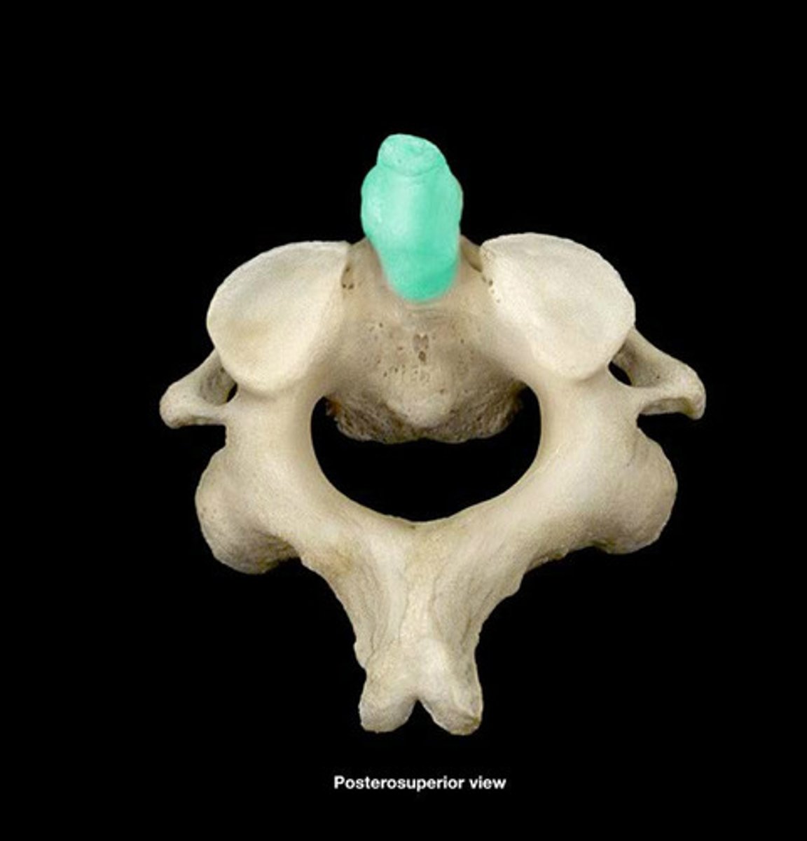 <p>A toothlike process projecting upward from the body of the axis around which the atlas rotates.</p>