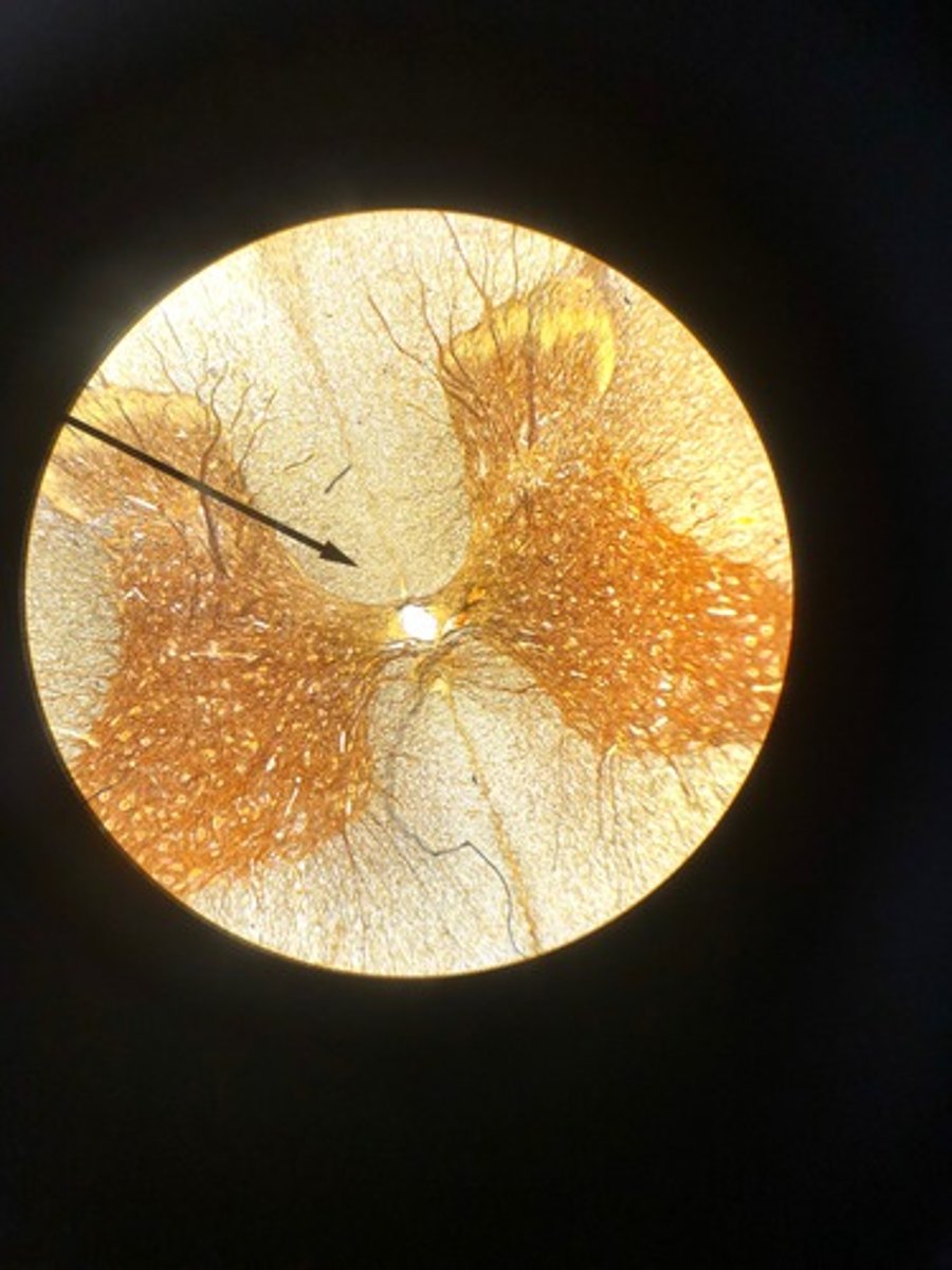 <p>Identify the general name for this light colored nervous tissue.</p>