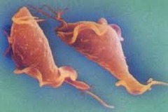 <p>any flagellated protozoan that lacks photosynthetic pigment and feeds on organic matter: often parasitic.</p>