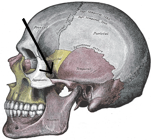 <p>Zygomatic arch - What is it? Bones involved?</p>