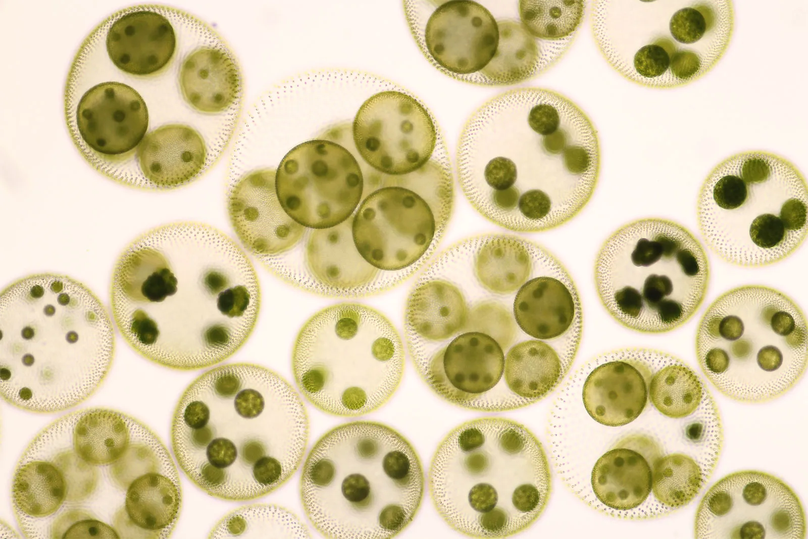 <p>Identify the genus of this Chlorophyta green algae.</p>