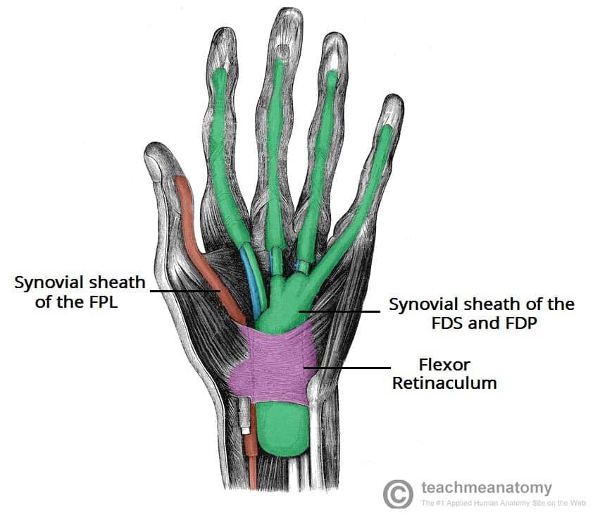 <p>median nerve damage</p><ul><li><p>what forearm muscles would be paralyzed?</p><ul><li><p>everything except flexor carpi ulnaris and flexor digitorum profundus</p></li></ul></li><li><p>what forearm muscle would now act unopposed to the wrist?</p><ul><li><p>flexor carpi ulnaris</p></li></ul></li><li><p>what type of deviation would result?</p><ul><li><p>ulnar deviation(ADduction)</p></li></ul></li></ul><p></p><p>ulnar nerve damage</p><ul><li><p>what forearm muscles would be paralyzed?</p><ul><li><p>flexor carpi ulnaris</p></li></ul></li><li><p>what forearm muscle would now act unopposed at the wrist?</p><ul><li><p>flexor carpi radialis</p></li></ul></li><li><p>what deviation would result?</p><ul><li><p>radial deviation(ABduction)</p></li></ul></li></ul><p></p><p>flexor retinaculum(transverse carpal ligament)</p><ul><li><p>tape that covers wrist</p></li><li><p>what nerve runs deep to this?</p><ul><li><p>median nerve</p></li></ul></li><li><p>how many tendons pass deep to this? which ones?</p><ul><li><p>9 tendons</p><ul><li><p>4 tendons from flexor digitorum superficialis </p></li><li><p>4 tendons from flexor digitorum profundus</p></li><li><p>1 tendon from flexor palmaris longus</p></li><li><p>runs from superficial —> deep</p></li></ul></li></ul></li><li><p>what is carpal tunnel syndrome?</p><ul><li><p>compression of median nerve under flexor retinaculum due to repetitive wrist movement</p></li></ul></li></ul><p></p>
